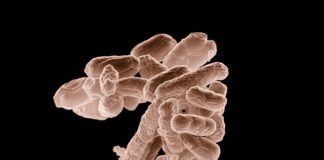 Jakie są objawy zużycia maglownicy?